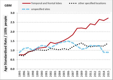 A graph showing an increase in the last twenty years in the incidence of glioblastoma multiforme in the temporal and frontal lobes when compared with other areas of the head